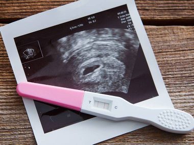 Test ciążowy leżący na zdjęciu USG